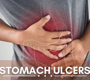 Ulcer problem Result